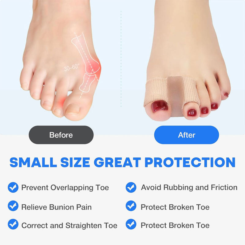 🦶✨ Toe separators & bunion correction – Pain-free relief for bunions & overlapping toes for women & men! ✨👟